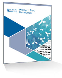 western blot handbook